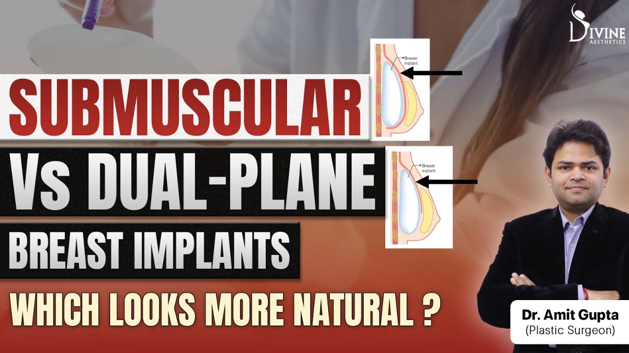 Submuscular vs Dual Plane Breast Implants | Which Looks More Natural? Dr Amit Gupta