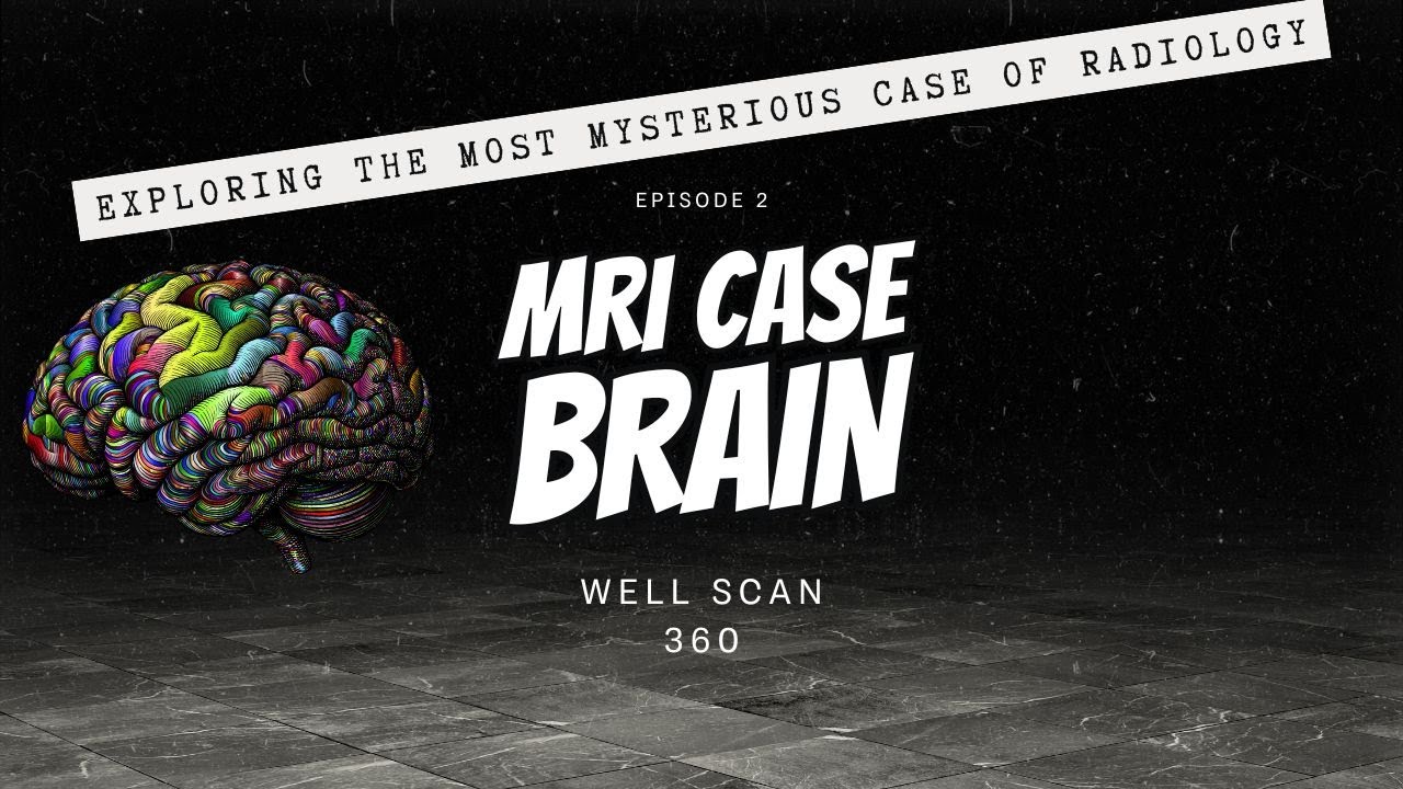 MRI Brain Case: Arachnoid Cyst, Neuroglial Cyst & Subgaleal Hematoma | Radiology Made Simple