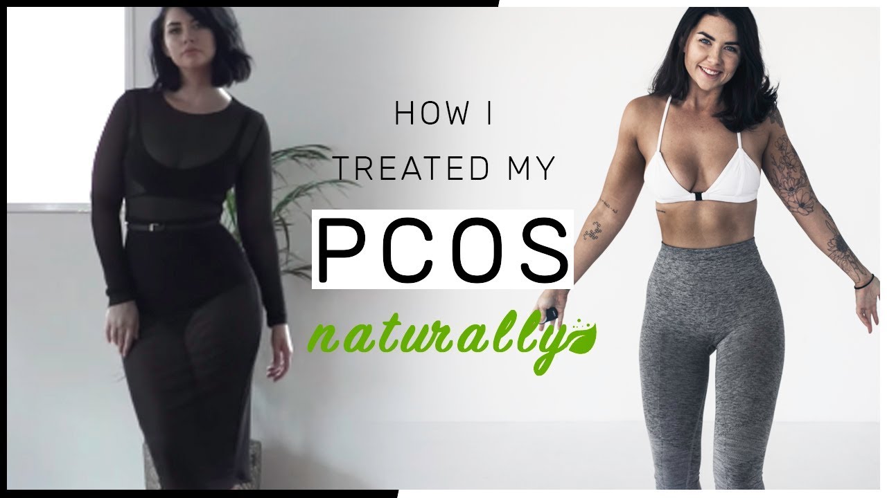 How I Treated My PCOS Naturally // Got my period back - No more acne