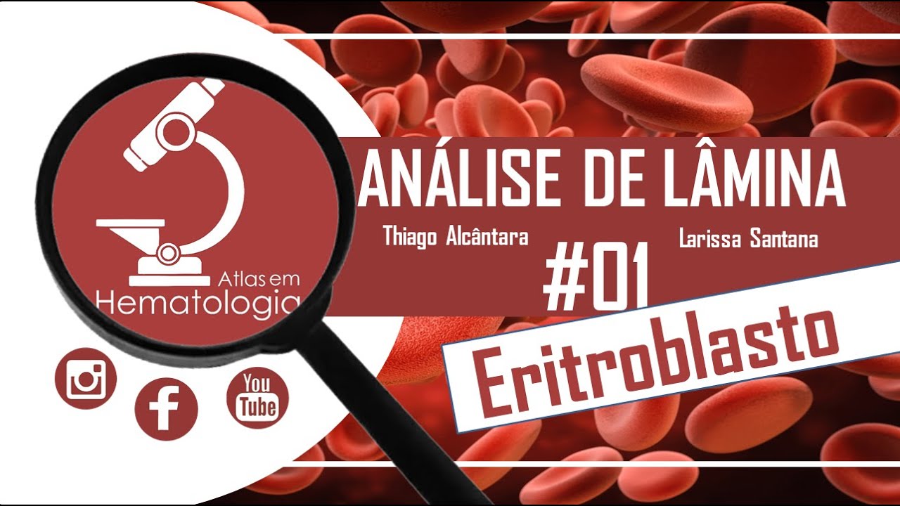 Análise de Lâmina #01-Eritroblastos