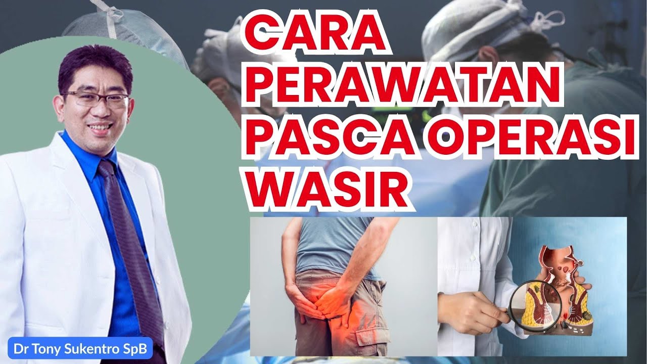 PASCA OPERASI WASIR GIMANA BIAR CEPAT SEMBUH ? #wasir #kesahatan #operasiwasir #dokterwasir