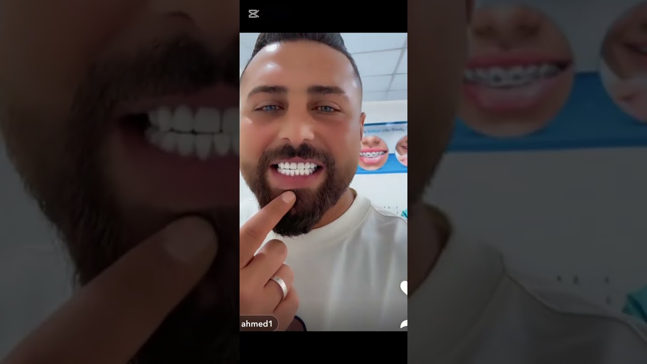 ريتشو وننوش فلوق تجميل اسنان ننوش مع الدكتور رامي😍بدنا نعمل تجميل للأنف كمان🤩🔥وصول عوني مع زوجتو✈️