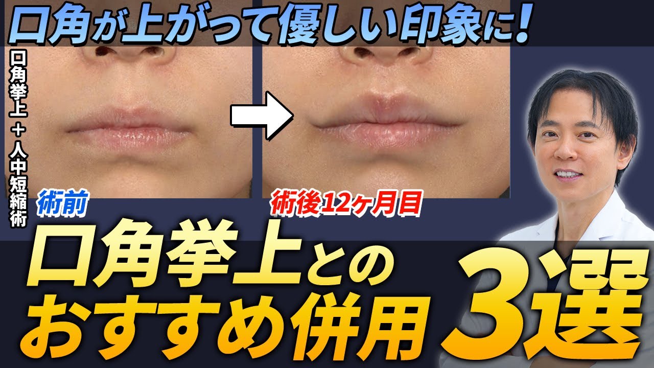 【美容整形】口角挙上を検討されている方必見！おすすめの併用施術をご紹介します