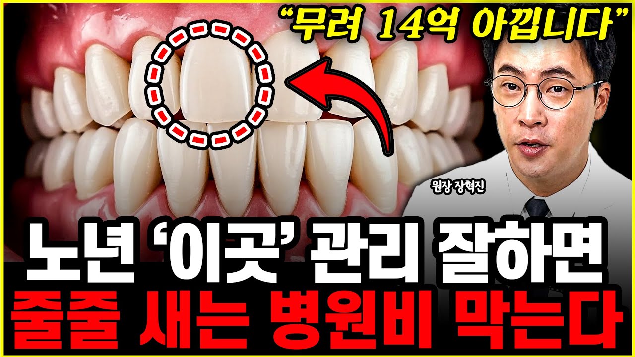 제발 임플란트부터 하지 마세요! 입속에 든 '14억' 날리기 싫다면 노년에 무조건 지켜야 할 '이곳'의 정체 l원장 장혁진(1부)
