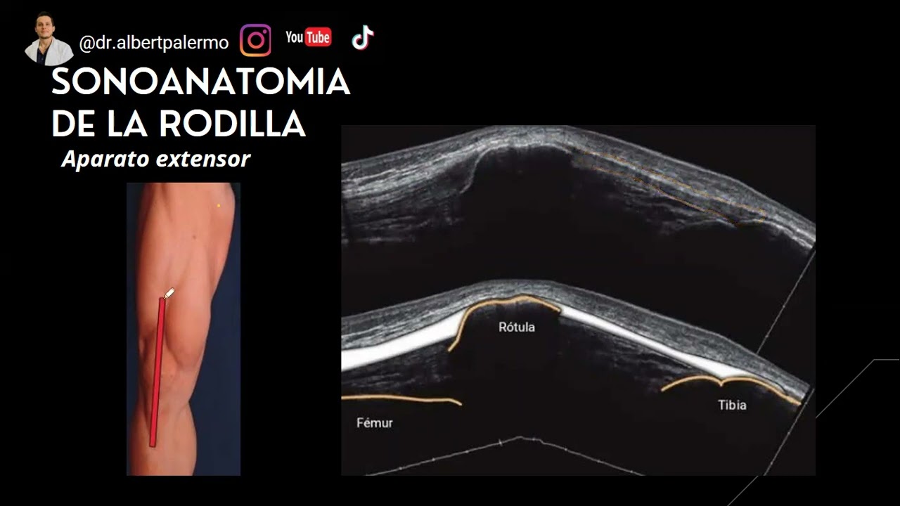 Ecografia rodilla 