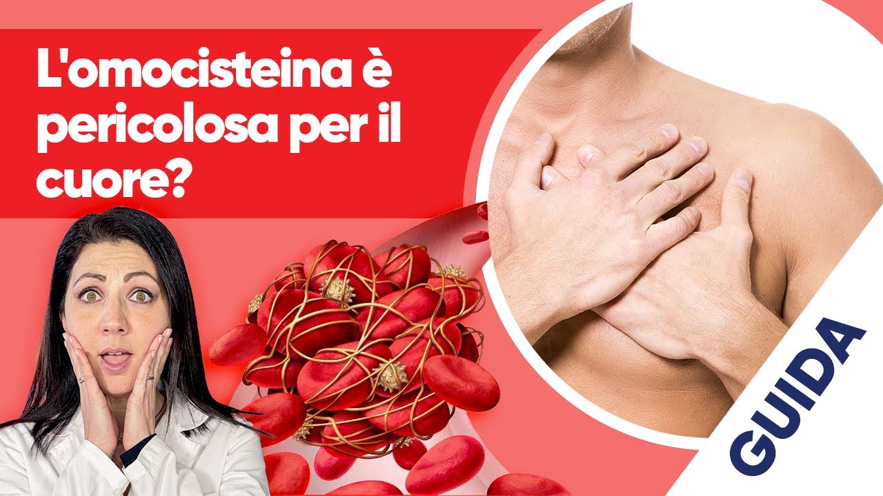 Omocisteina alta: sintomi, cause e rischi per la salute