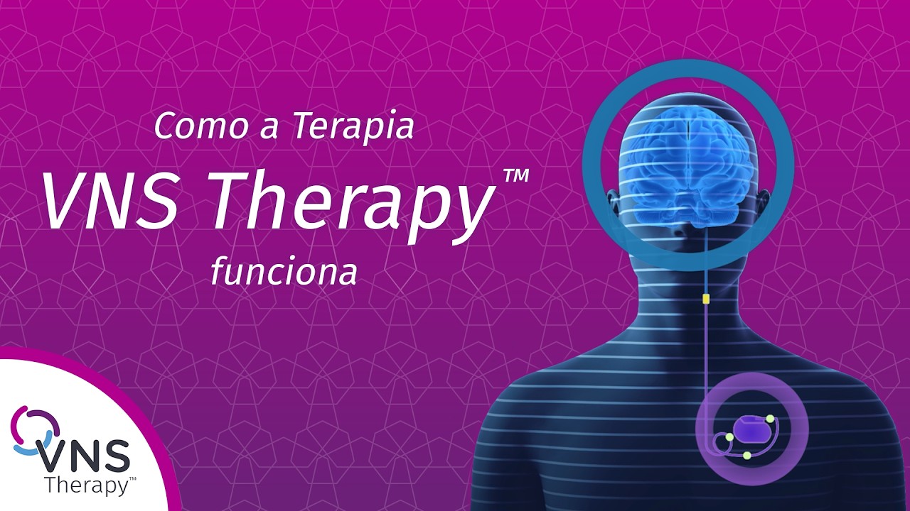 Como Funciona a Terapia VNS para Epilepsia | Estimulação do Nervo Vago Explicada