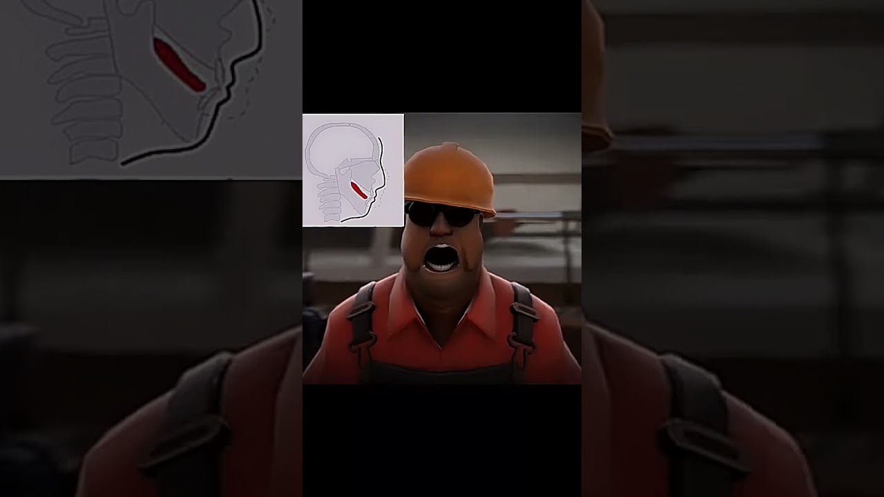 Mewing team fortress 2 #baybay #edit #teamfortress2