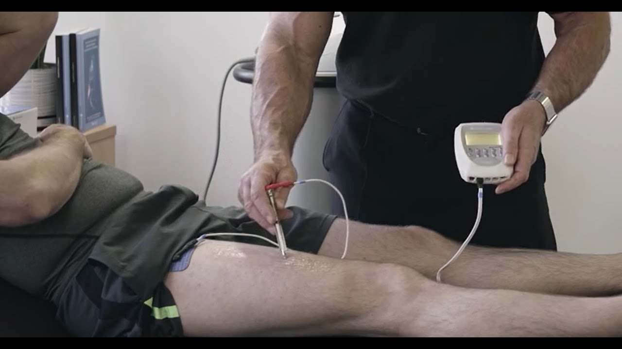 Chattanooga Hints and Tips series: NMES - establishing accurate electrode placement