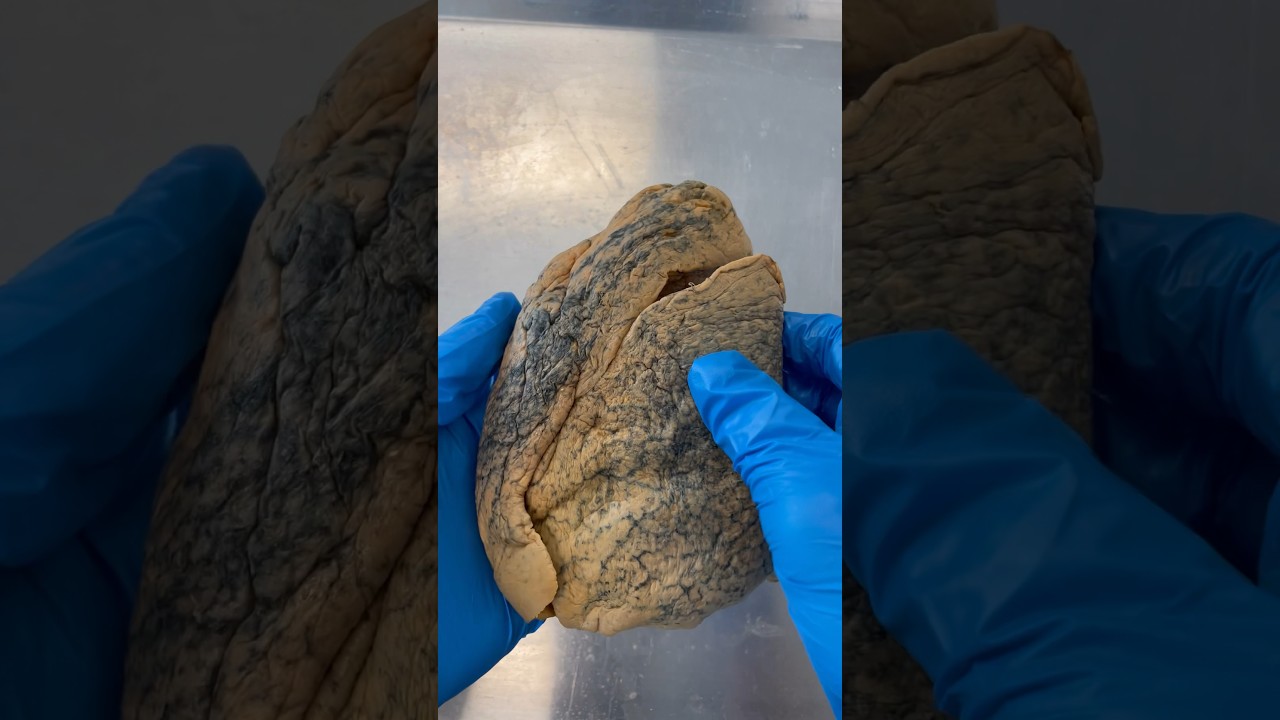 Real Human Lung!