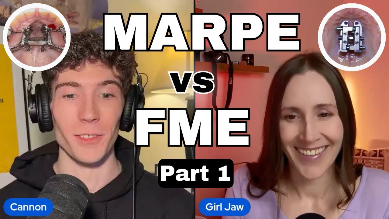 MARPE против FME. Какой экспандер лучше?