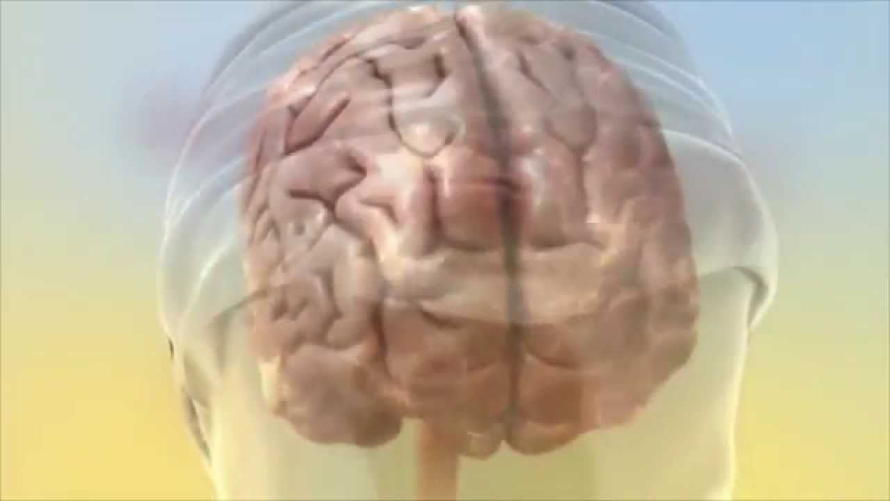 Acoustic CR Neuromodulation Tinnitus Treatment