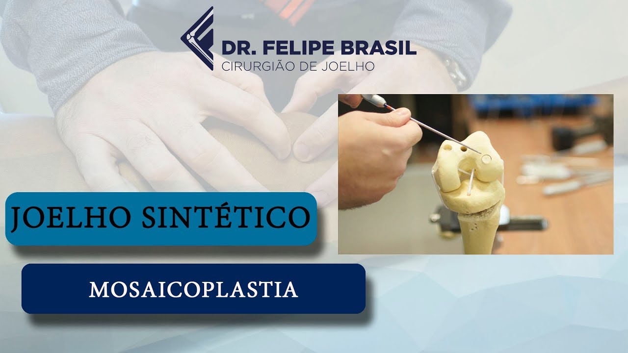 MOSAICOPLASTIA - WORKSHOP