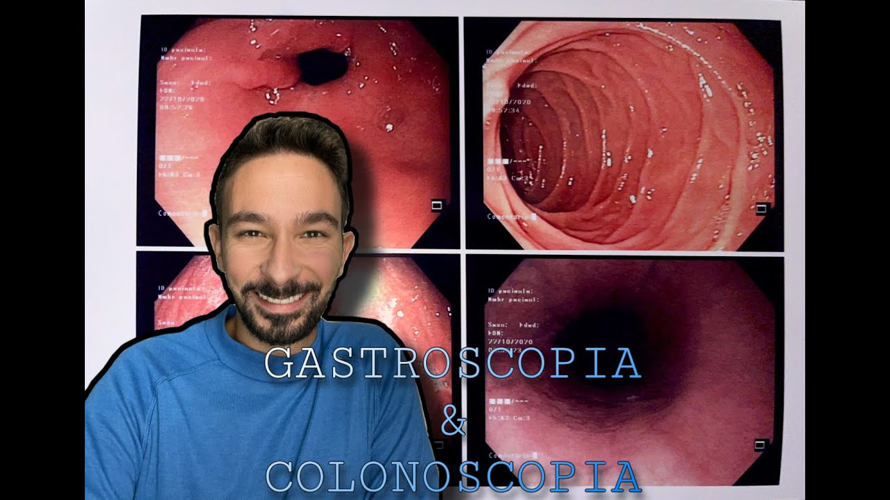Endoscopia: Colonoscopia y Gastroscopia. ¡¡Mi experiencia!!