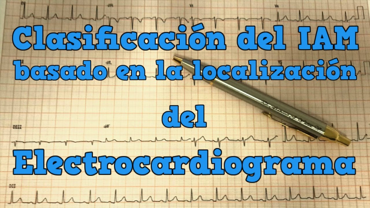 【Clasificación del IAM según su localización en el Ekg】