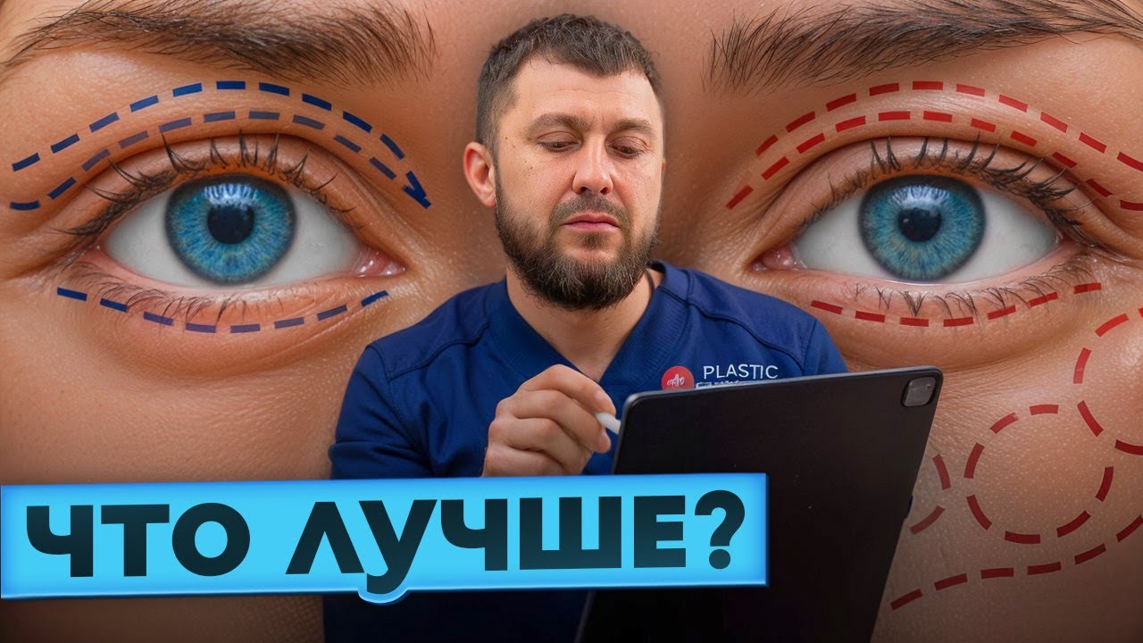 5 Отличий Блефаропластики от Периорбитопластики