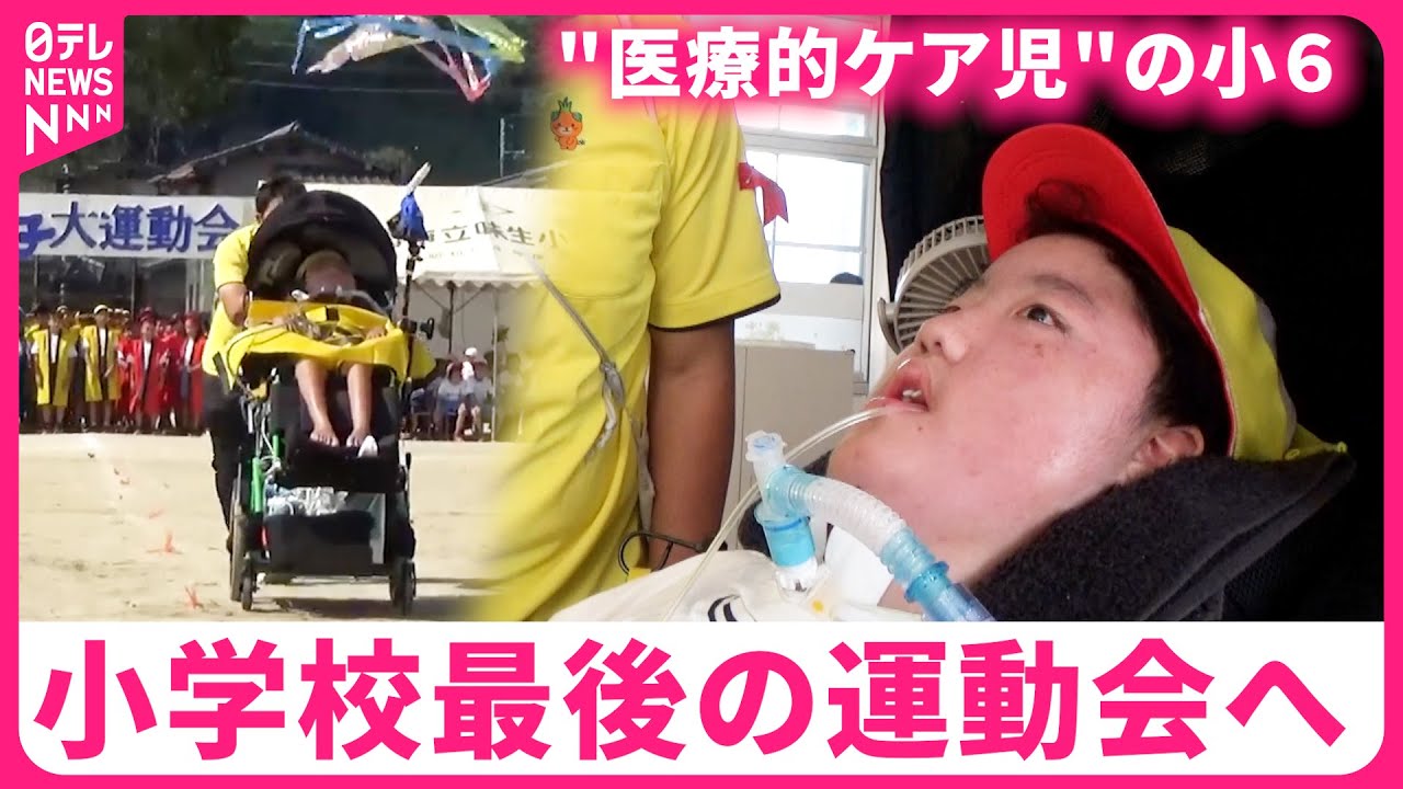 【挑戦！】脊髄性筋萎縮症 