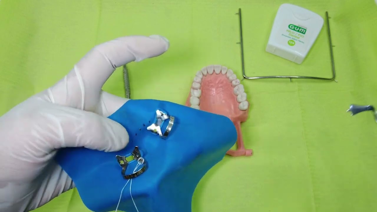 Aislamiento con Dique de hule dental/Aislamiento obsoluto