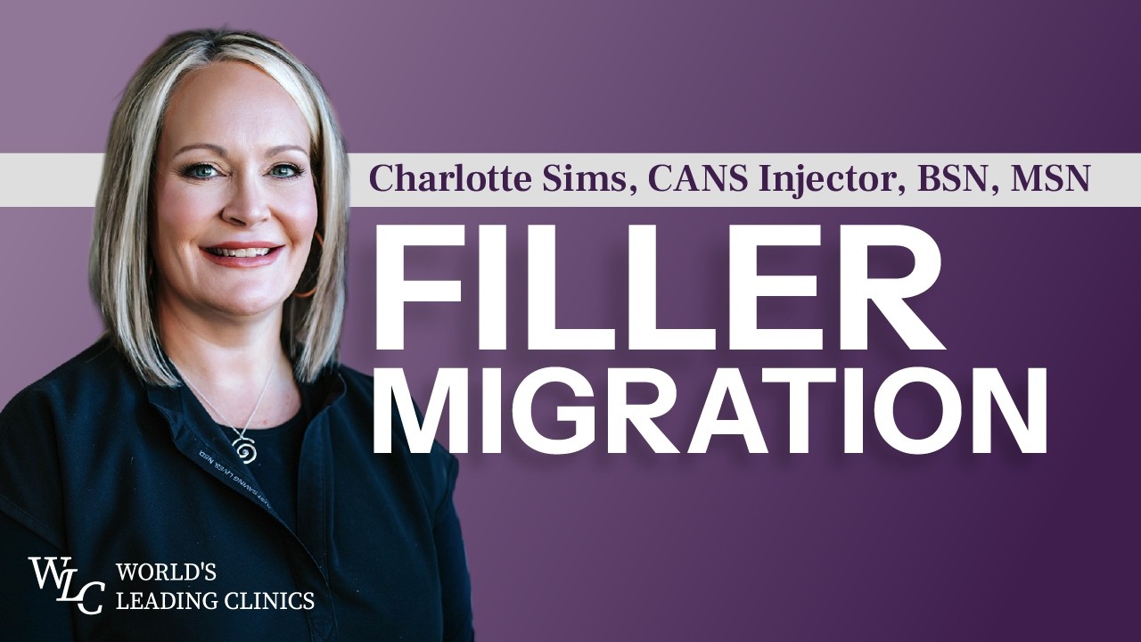 Filler Migration Explained: Causes, Signs & How to Prevent It