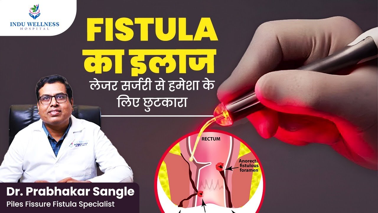 Fistula का इलाज | लेजर सर्जरी से हमेशा के लिए छुटकारा | Dr. Prabhakar Sangle