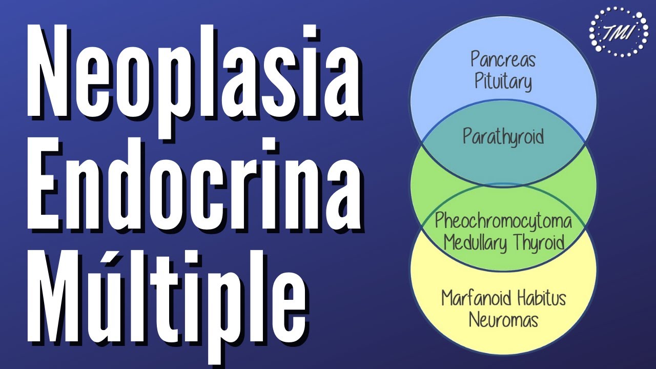 Neoplasia Endocrina Multiple Explicada Claramente