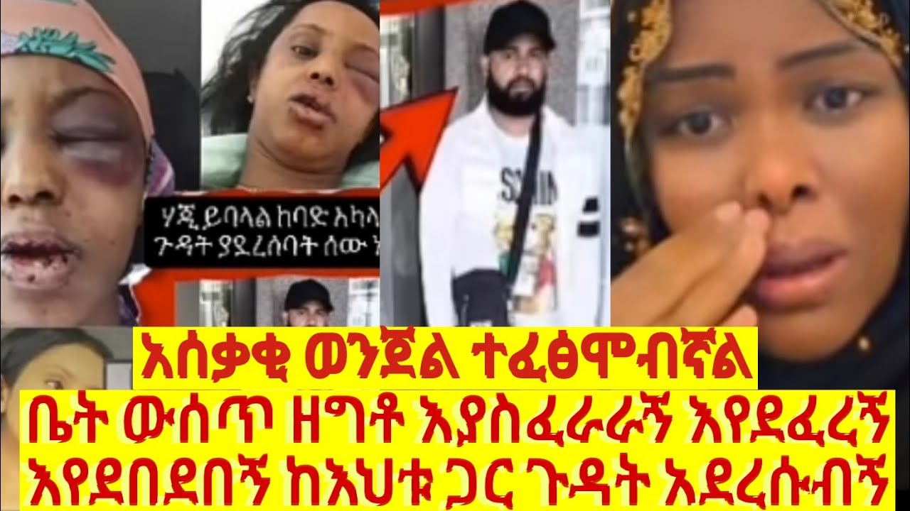 ውጭ ሀገርም እንደዚ ይደረጋል እንዴ አሰከፌ የወንጀል ታሪክ በህግ ሊጠየቅ ይገባል 😭