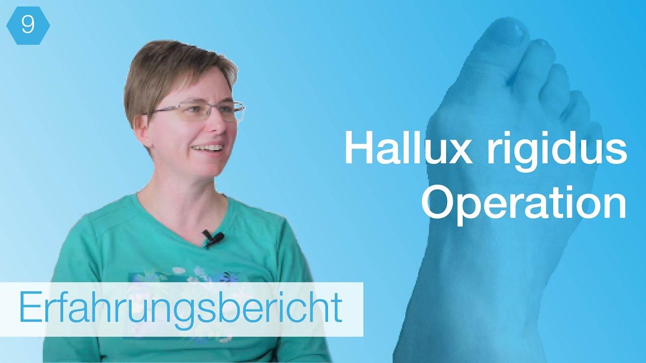 #9 Hallux rigidus OP Erfahrungsbericht - Schmerzen durch Operation lindern?