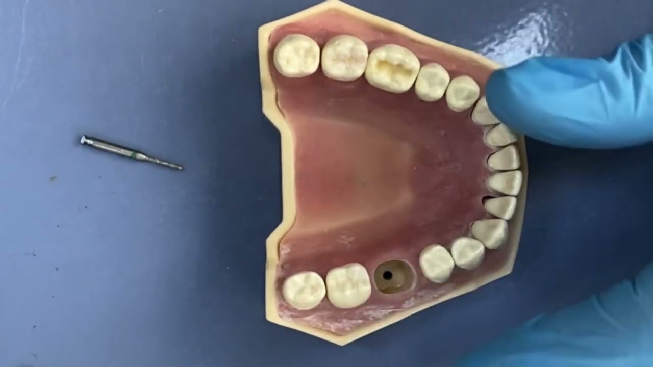 Preklinik Black 1 kavite kompozit dolgu