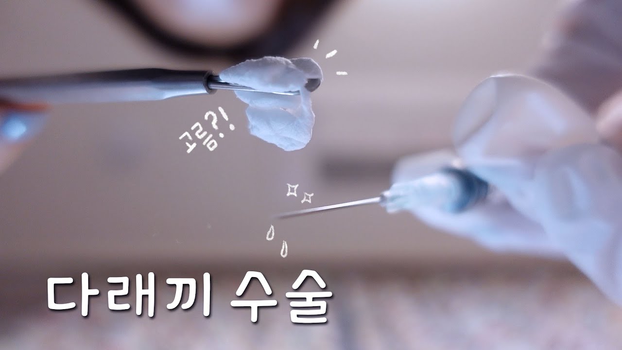 ASMR 다래끼👁 째고갈래?🔪 다래끼 수술ㅣ안과 롤플ㅣStye Treatment, SurgeryㅣSurgery role play