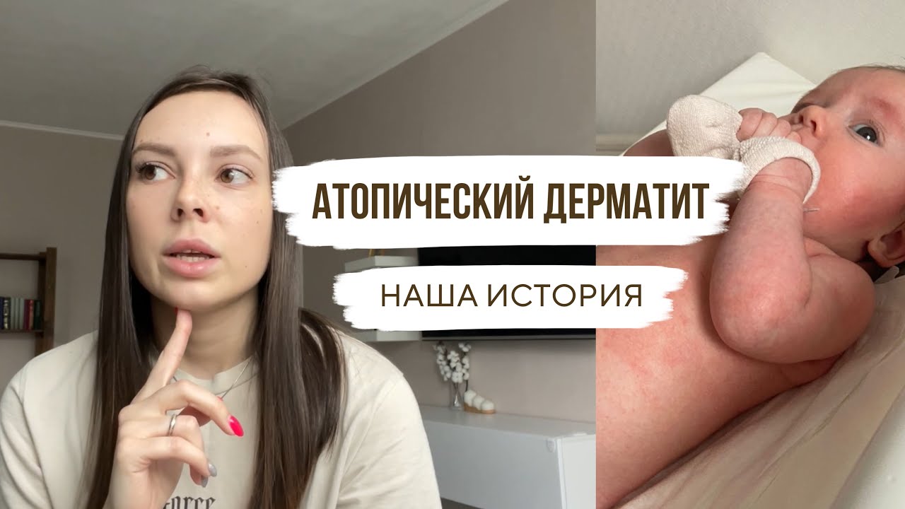 АТОПИЧЕСКИЙ ДЕРМАТИТ😨НАША ИСТОРИЯ | ЛЕЧЕНИЕ АТОПИЧЕСКОГО ДЕРМАТИТА