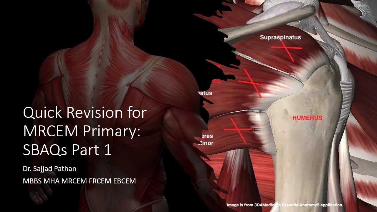 MRCEM PRIMARY SBAQs. #MEM #ANATOMY #EM #GWU #MRCEM #FRCEM #SAJJADPATHAN #EMERGENCYMEDICINE #FACEM