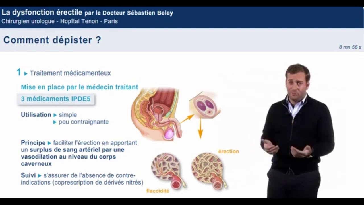 Dysfonction &eacute;rectile et troubles de l'&eacute;rection: Que faut il savoir de la dysfonction &eacute;rectile ?