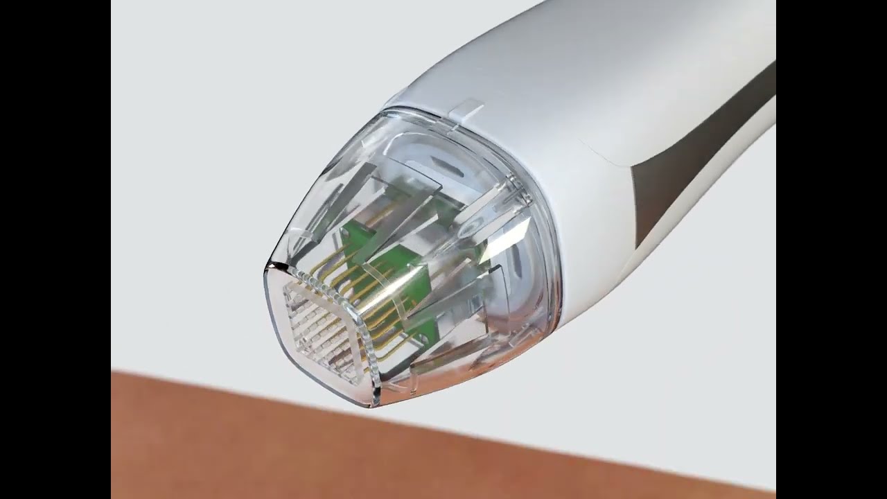 VirtueRF RF microneedling revolutionaire behandeling huidverstrakking huidverbetering huidverjonging