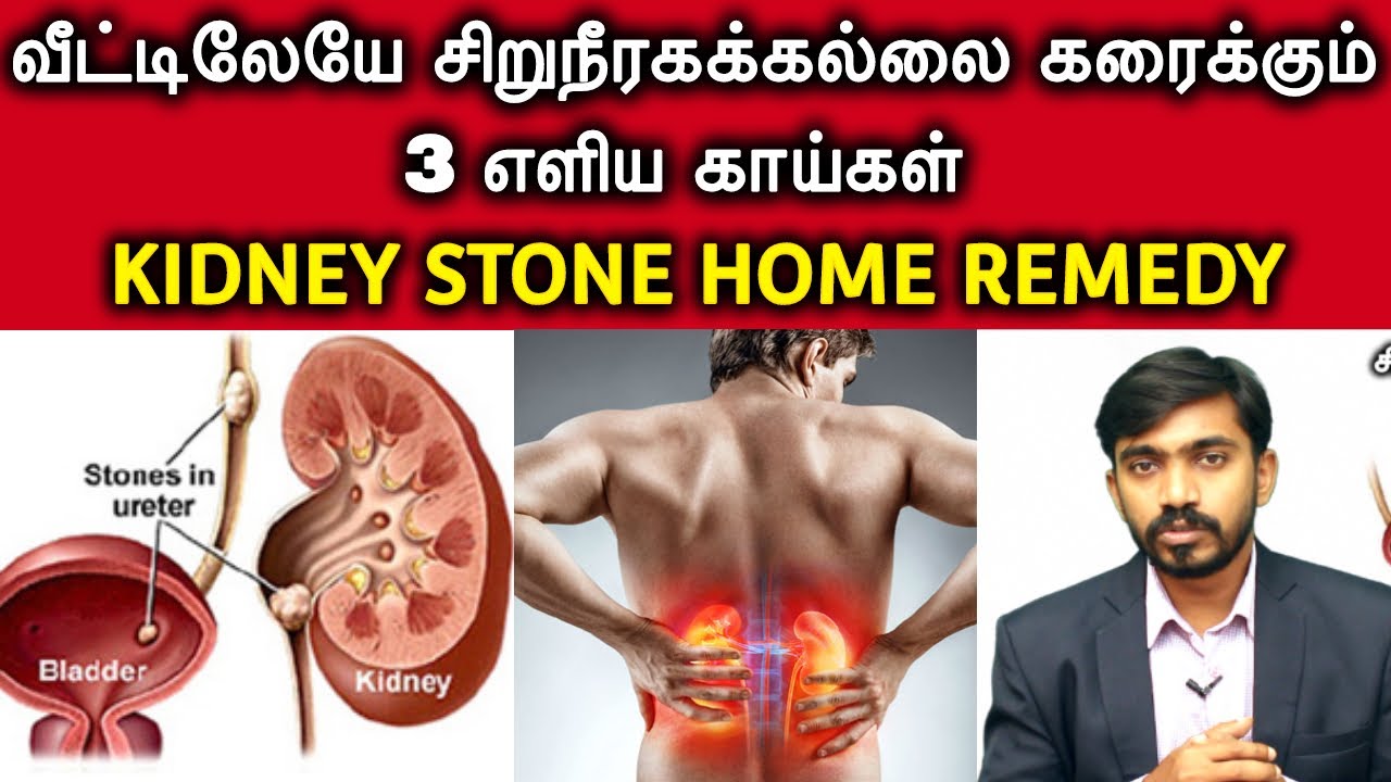 சிறுநீர் கல் கரைத்து வெளியேற்றும் மூன்று காய்கள்... | VEGETABLES THAT CRUSH KIDNEY STONE | DrSJ