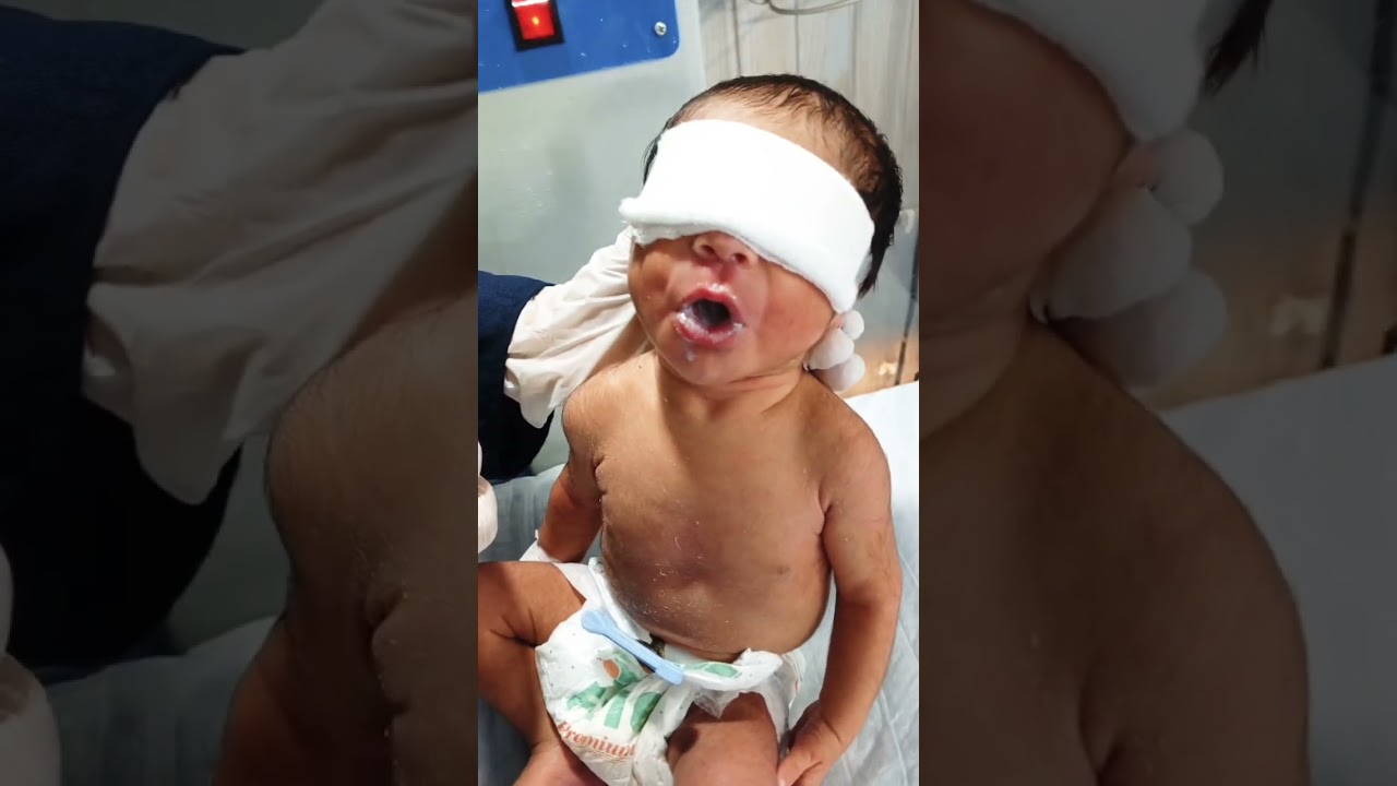 Little baby very hangry and feeding #newbornbaby #cutebaby #neonatologist #miraclebaby