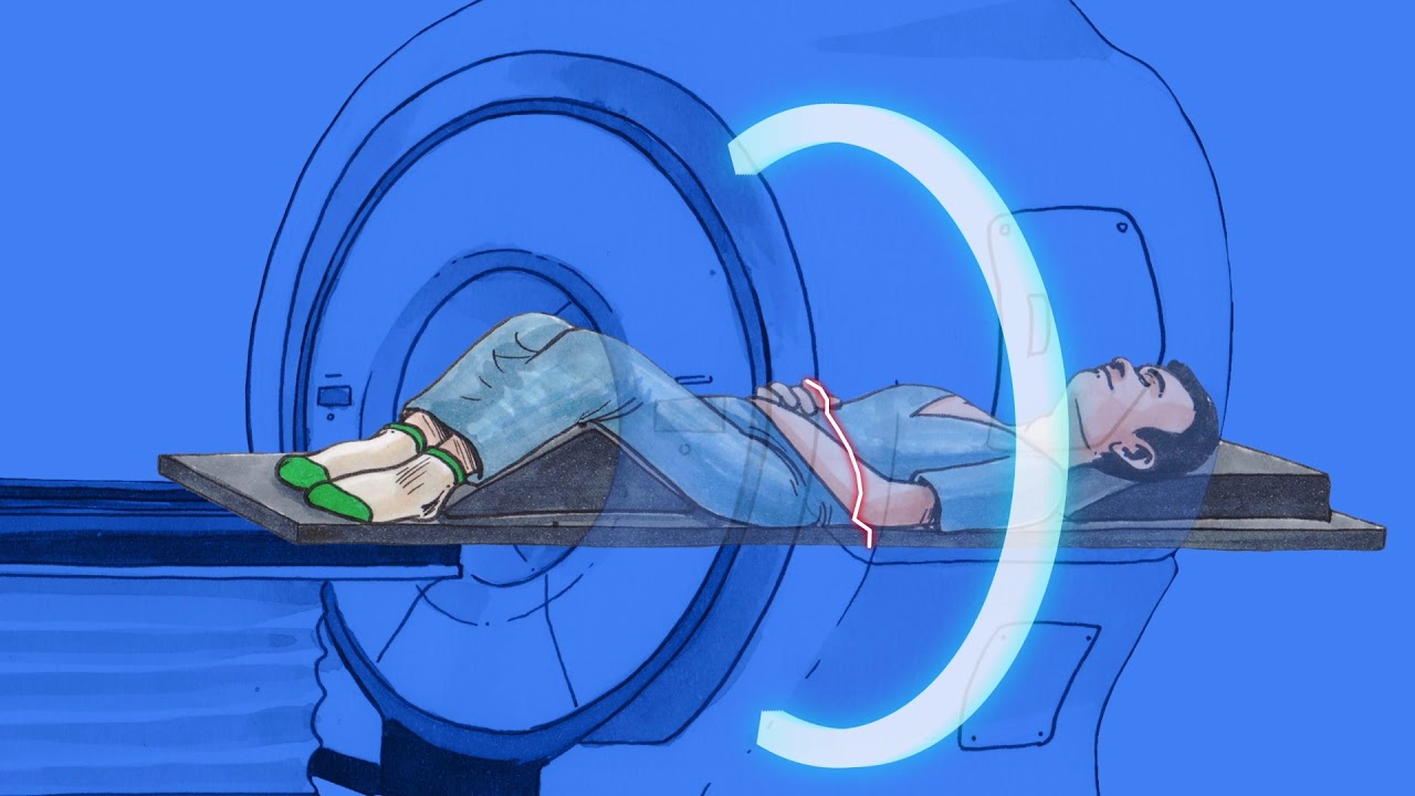 Tomotherapy, el sistema de radioterapia más preciso para el tratamiento del cáncer