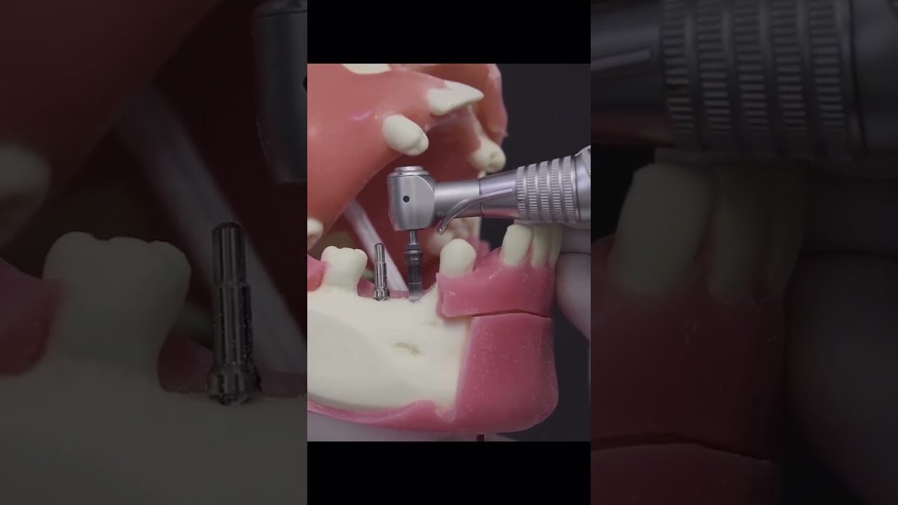 Treinamento: Cirurgia de implantes dentários.          #odontologia #odonto #dentista #implantes