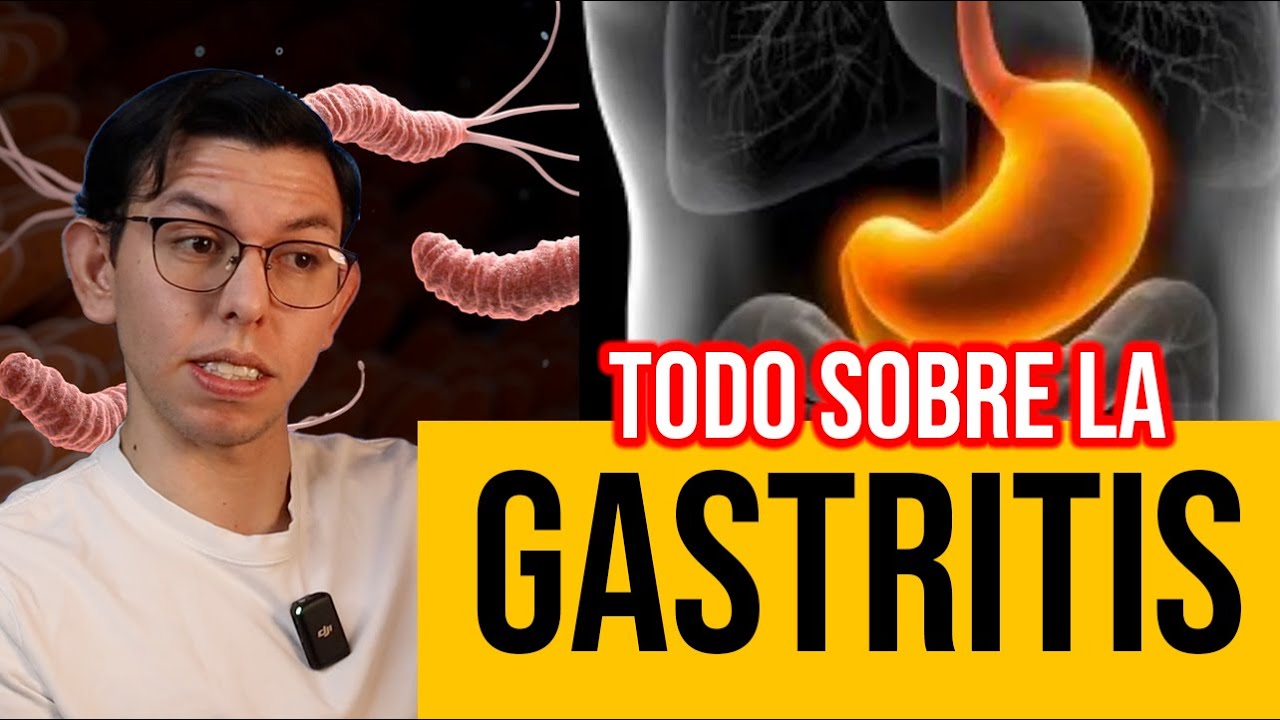 ¿Qué tan peligroso es tener GASTRITIS? Todo sobre la gastritis | DrPoloGuerrero