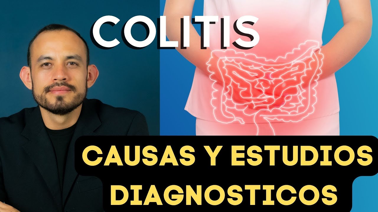 ⚠️ 9 DATOS IMPORTANTES sobre la COLITIS: S&iacute;ntomas, Causas, Estudios, Tratamiento