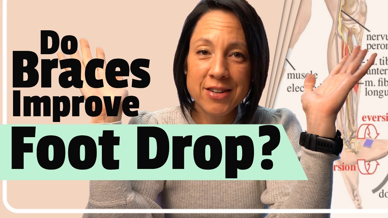 Do braces work for foot drop?