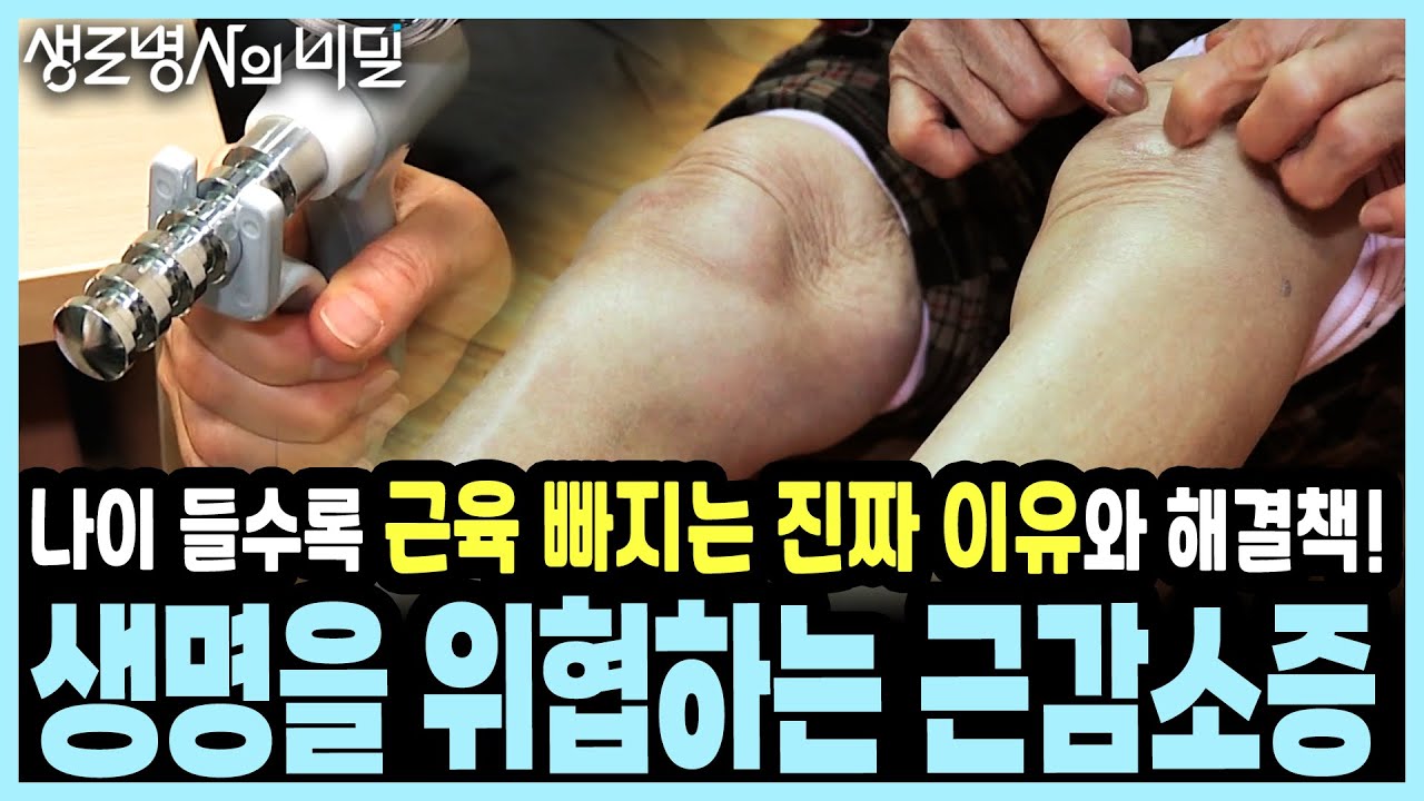 근력 약하면 사망률 9배 폭등! 65세 이상 5명 중 1명이 앓는 '노인 질병'의 충격적 실태 I KBS 20170308 방송
