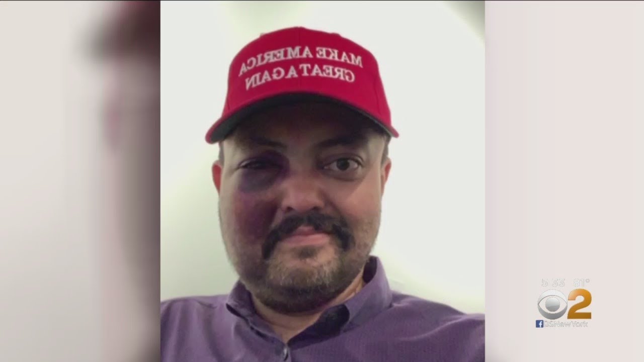 Man Attacked For Wearing MAGA Hat Gets Gift From President