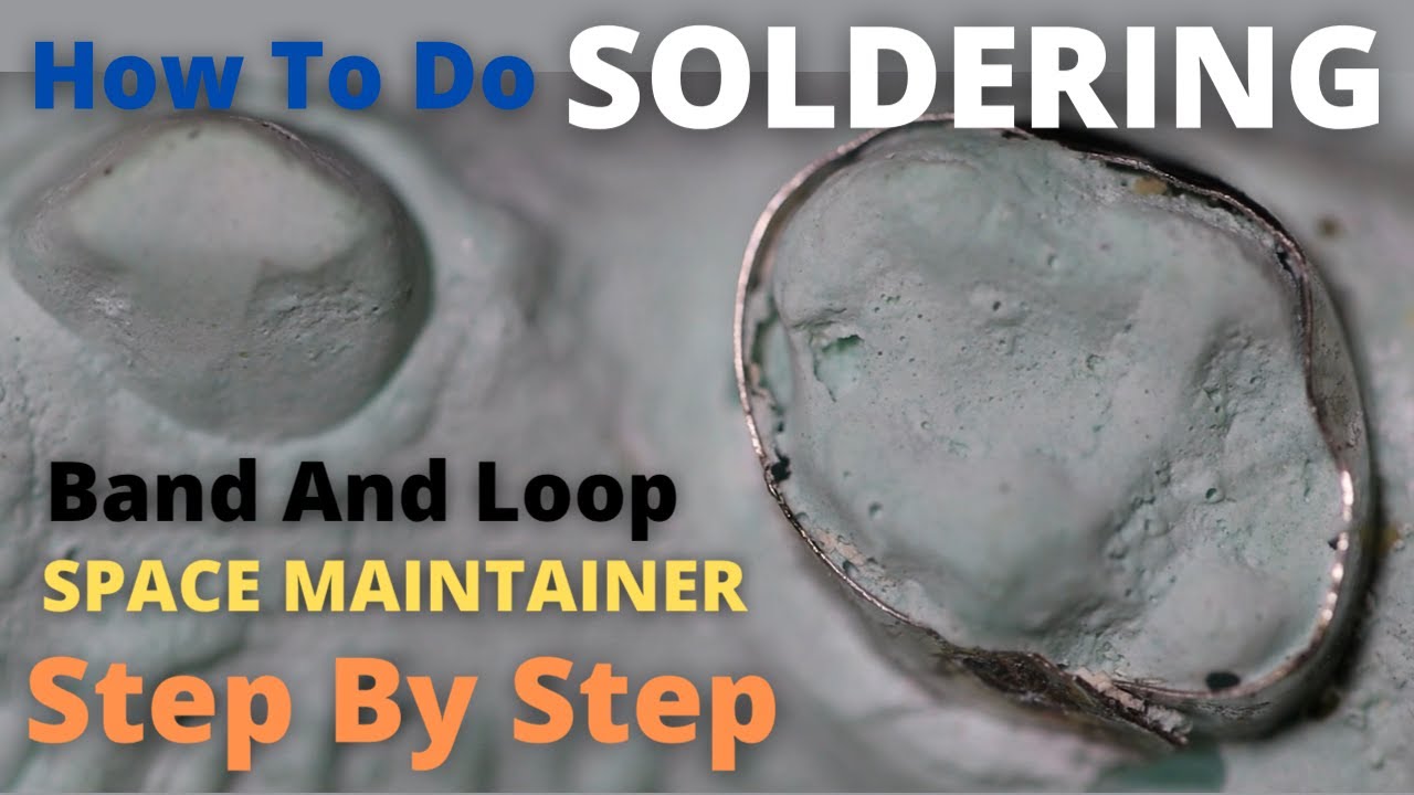How To Do Soldering in Band and Loop Space Maintainer | Step By Step Demonstration