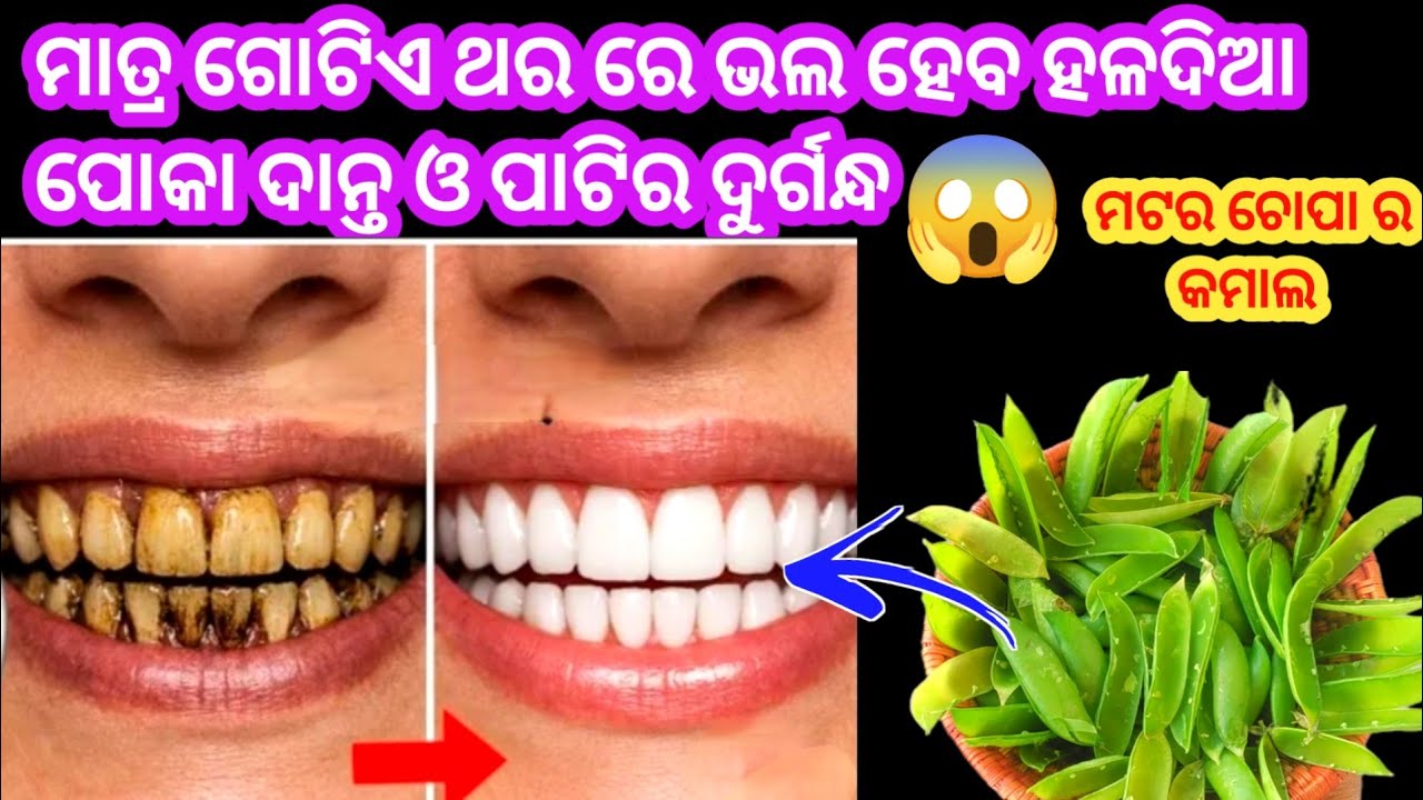 ମାତ୍ର ୨ ମିନିଟ୍ ରେ ଭଲ ହେବ👉ଗନ୍ଧିଆ ପୋକା ଦାନ୍ତ, ଦାନ୍ତ ବିନ୍ଧା, ପାଟିର ଦୁର୍ଗନ୍ଧ ଓ ଅନେକ ସମସ୍ୟା 😱ଜବରଦସ୍ତଉପାୟ 