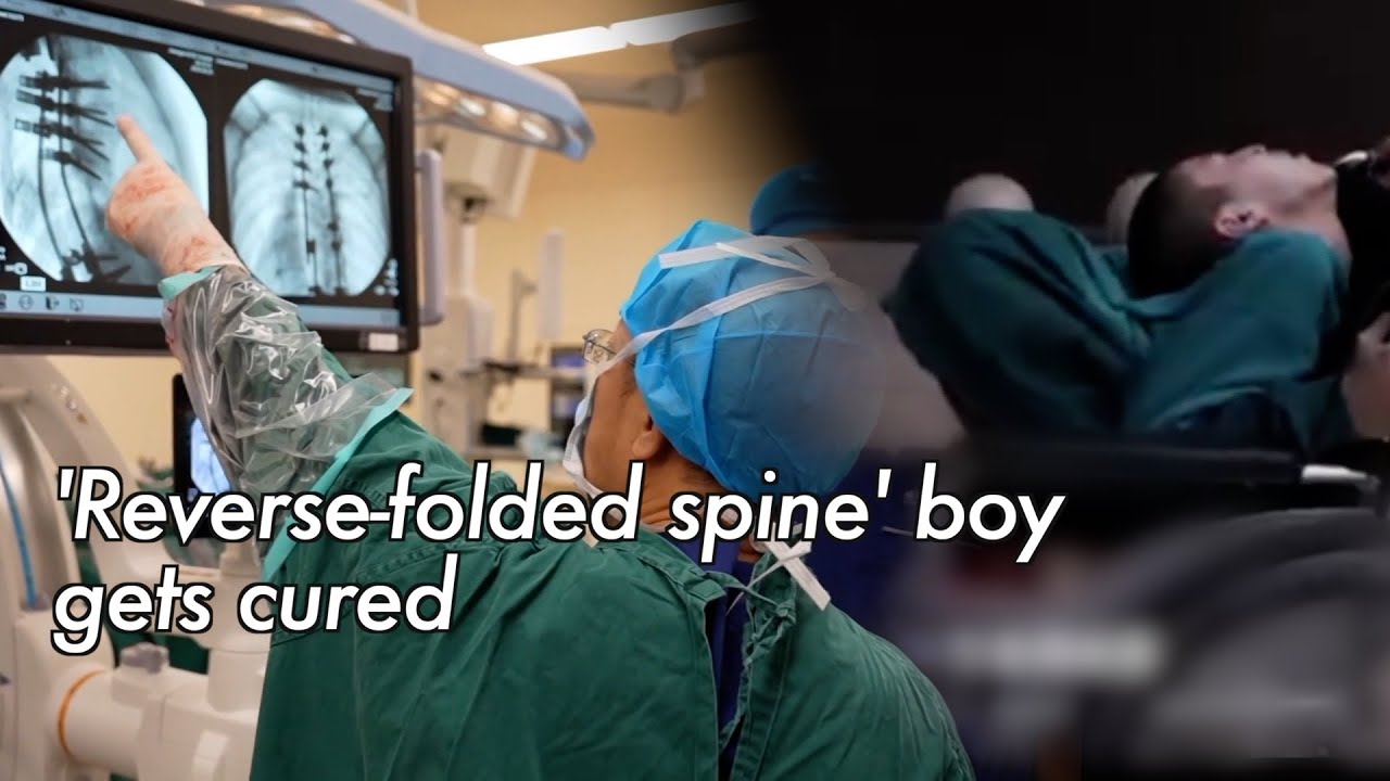 World's First Corrective Surgery For Reverse-Folded Spine Achieved In China