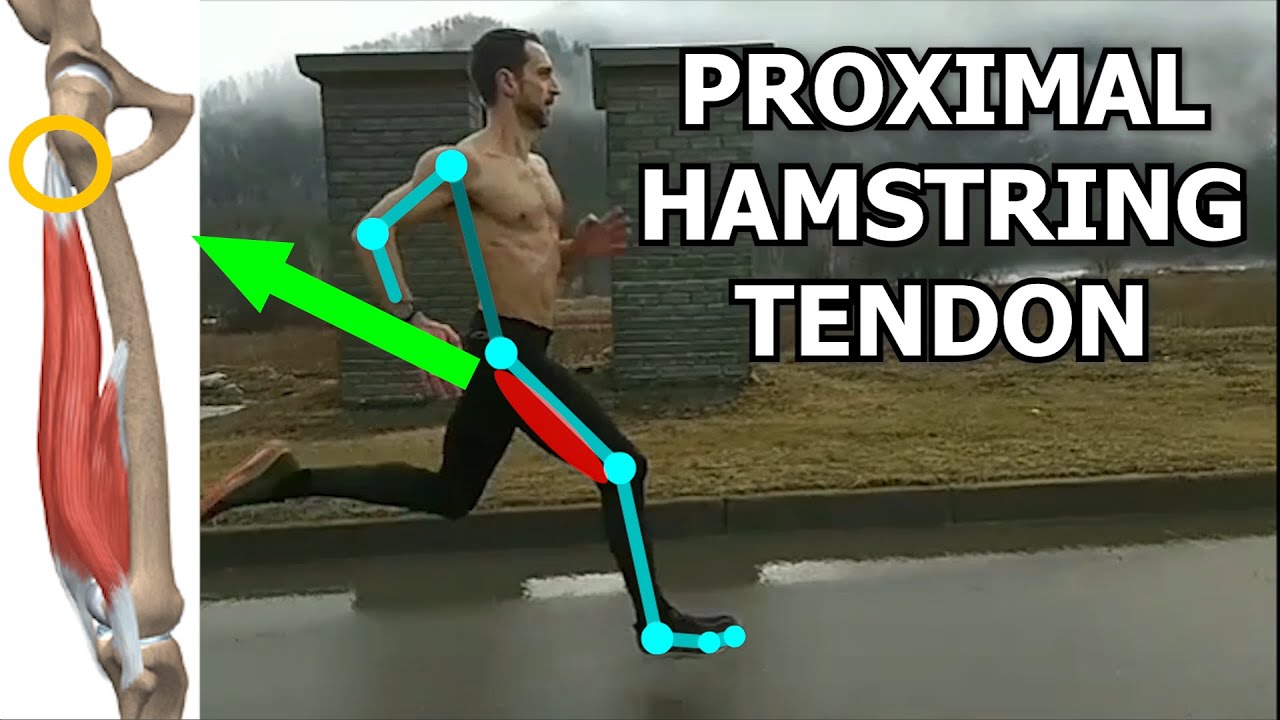 Running Exercises: Why Target the Proximal Hamstring Tendon?
