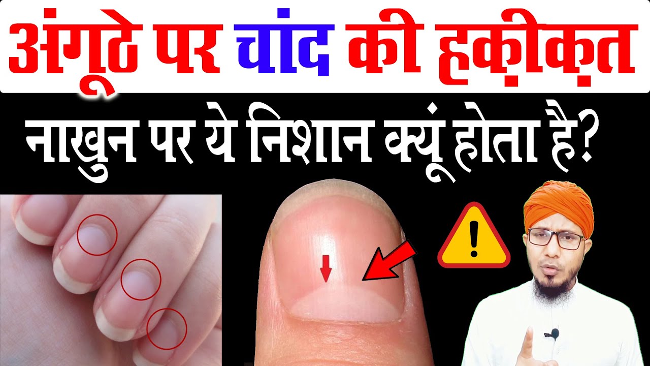 nakhun par safed nishan ka matlab kya hai | अंगूठे पर चांद का निशान कियू होता है | chand ka nishan