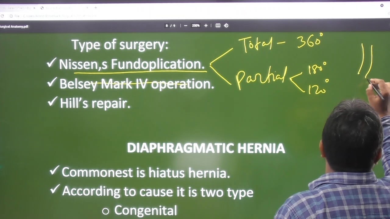 L-1 surgery(introdution)