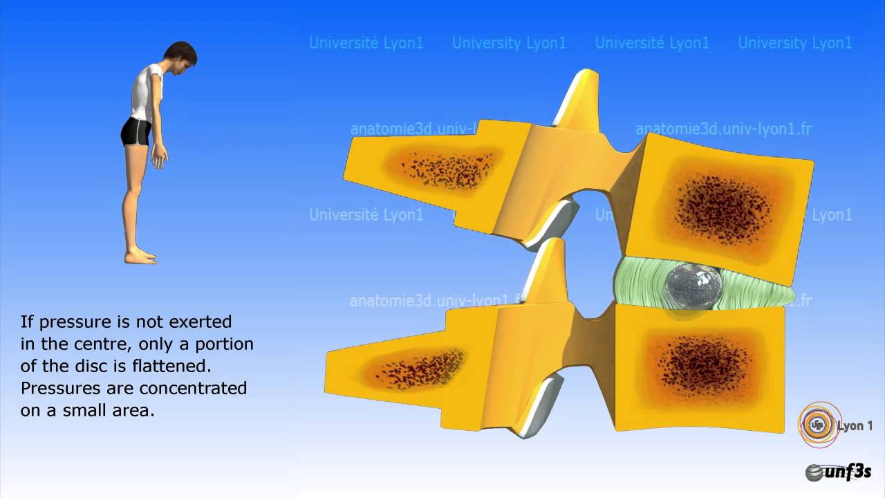 The intervertebral disc
