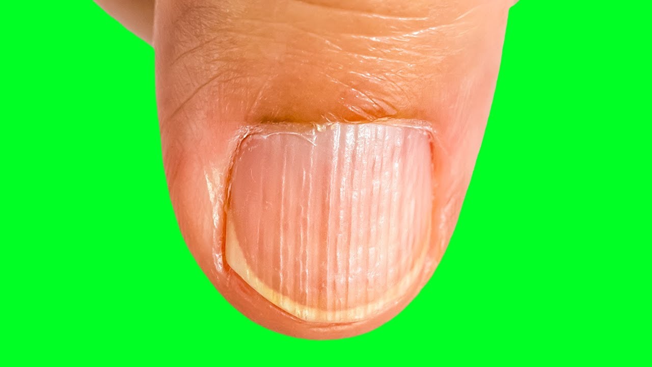 10 Zeichen f&uuml;r einen m&ouml;glichen Proteinmangel